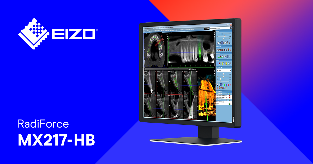 RadiForce MX217-HB | Farbmonitor für Dental-Bereich